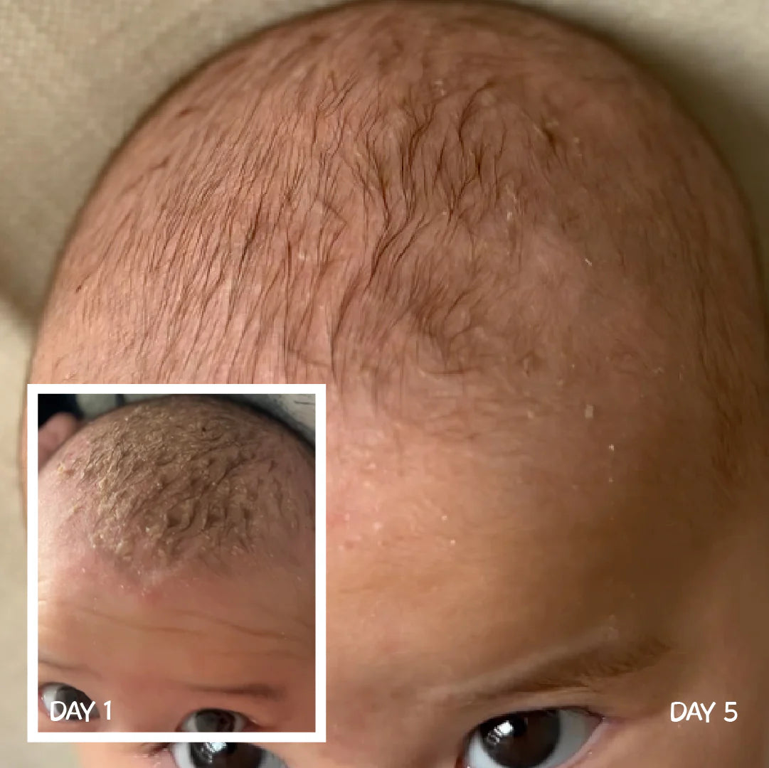 MooGoo Scalp Cream 120g